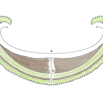 Thielenbruch